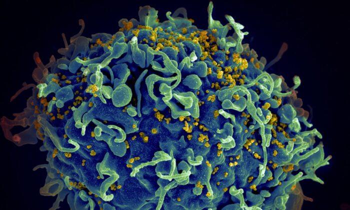 Highly Infectious, More Damaging HIV Variant Found in the Netherlands