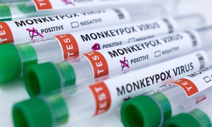 Florida Confirms Its First Case of Child Monkeypox