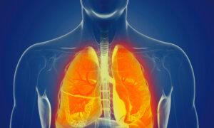 Poor Oral Health Speeds Up Irreversible Lung Disease: Study