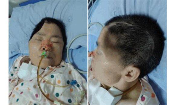 After 3 years in prison, Falun Gong practitioner Liao Guanghui was sent home in a vegetative state. She died at the age of 70 on March 23, 2023. (minghui.org)