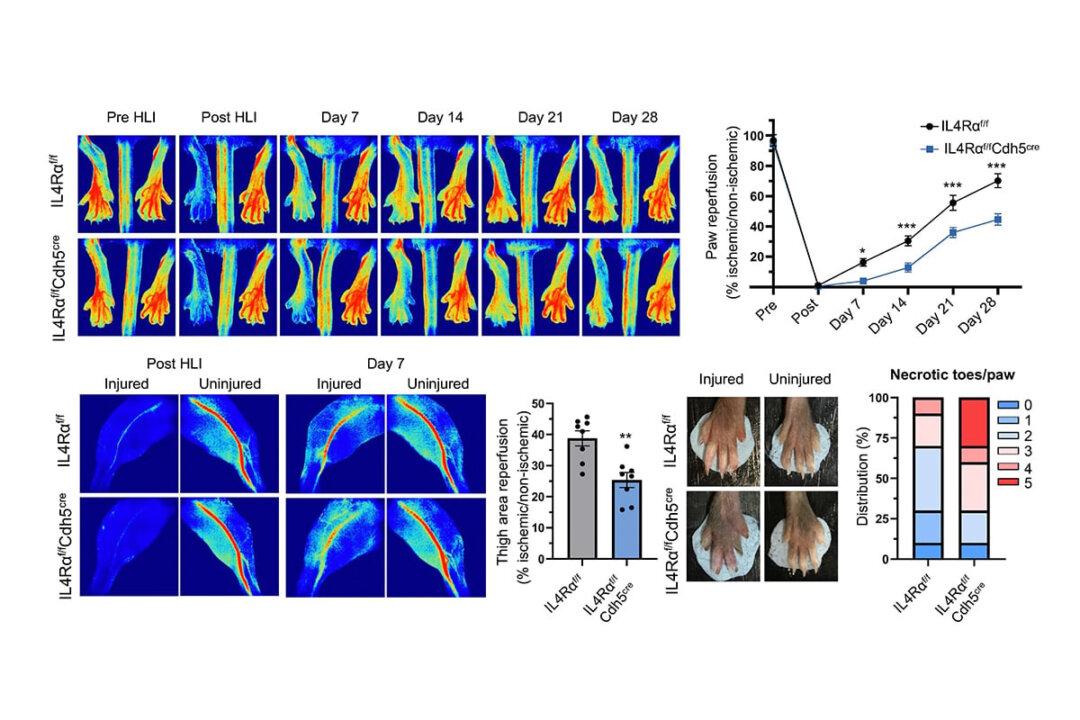 Research Discovers Cytokines Promote Blood Vessel Growth, Helps Treat Ischemic-Induced Tissue Damage