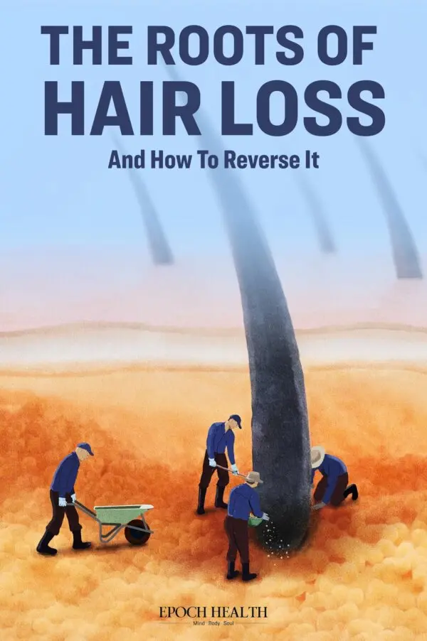 The Roots of Hair Loss