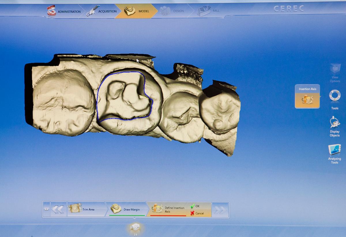 With Single Visit Dentistry, the Dentist’s Office Is De-fanged