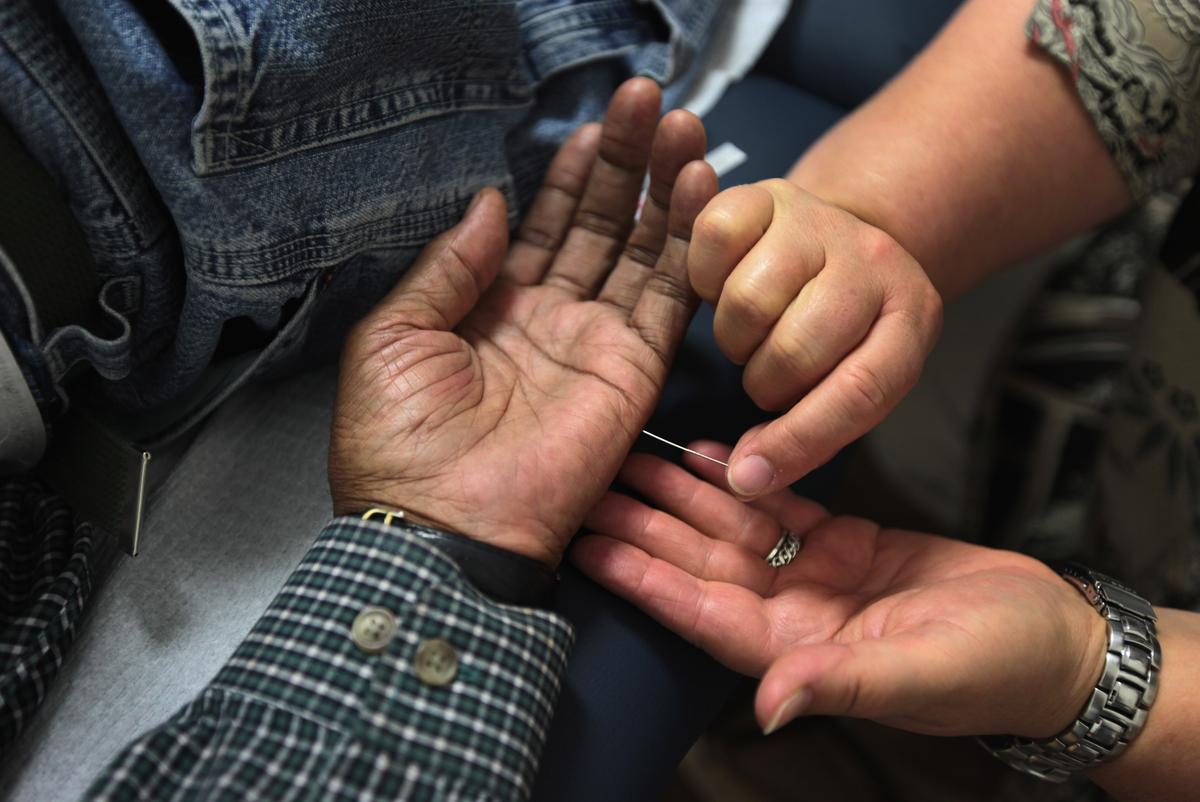 Acupuncture: A Natural Remedy for Pain 