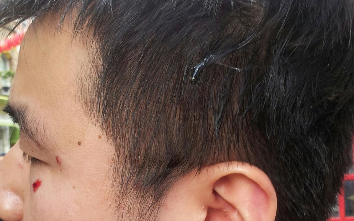 Attacks in London’s Chinatown Raise Concerns of Hate Campaign