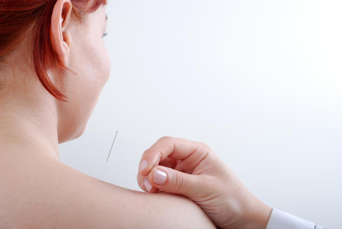 Acupuncture Physical Medicine for Pain and Stress