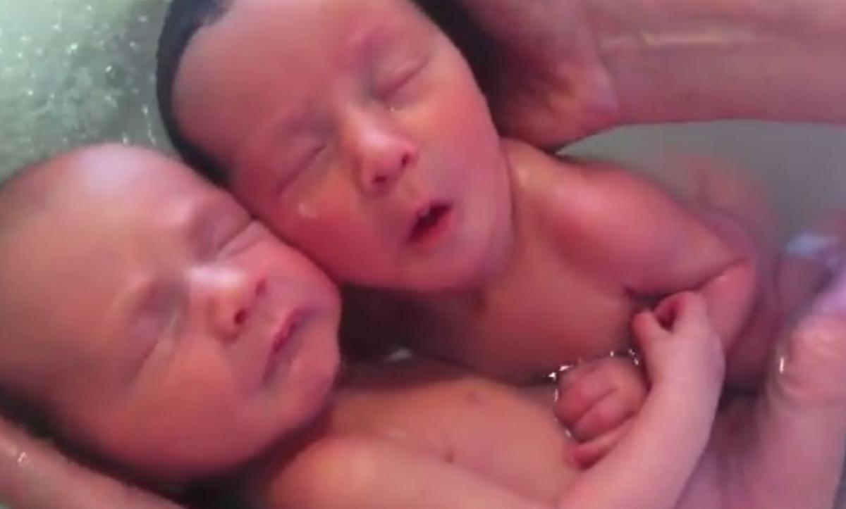 Newborn Twins: Video of Hugging Babies Goes Viral