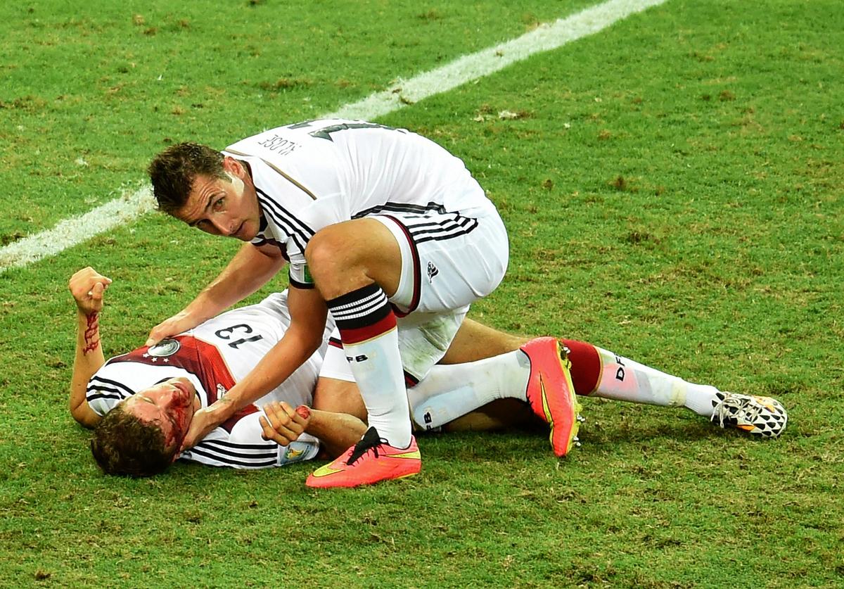 Thomas Mueller Injury Update: Germany, Bayern Munich Forward Receives Stitches, Could Play USA (+Photos)