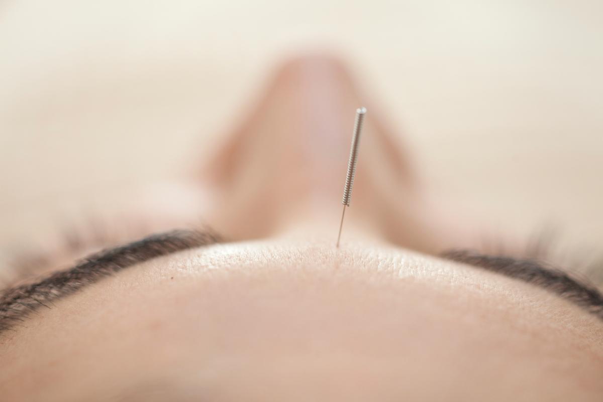 3 Great Reasons To Get Acupuncture This Winter