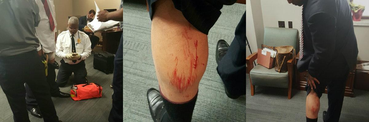 Mayor of Alabama and Council Member Involved in Bloody Fight