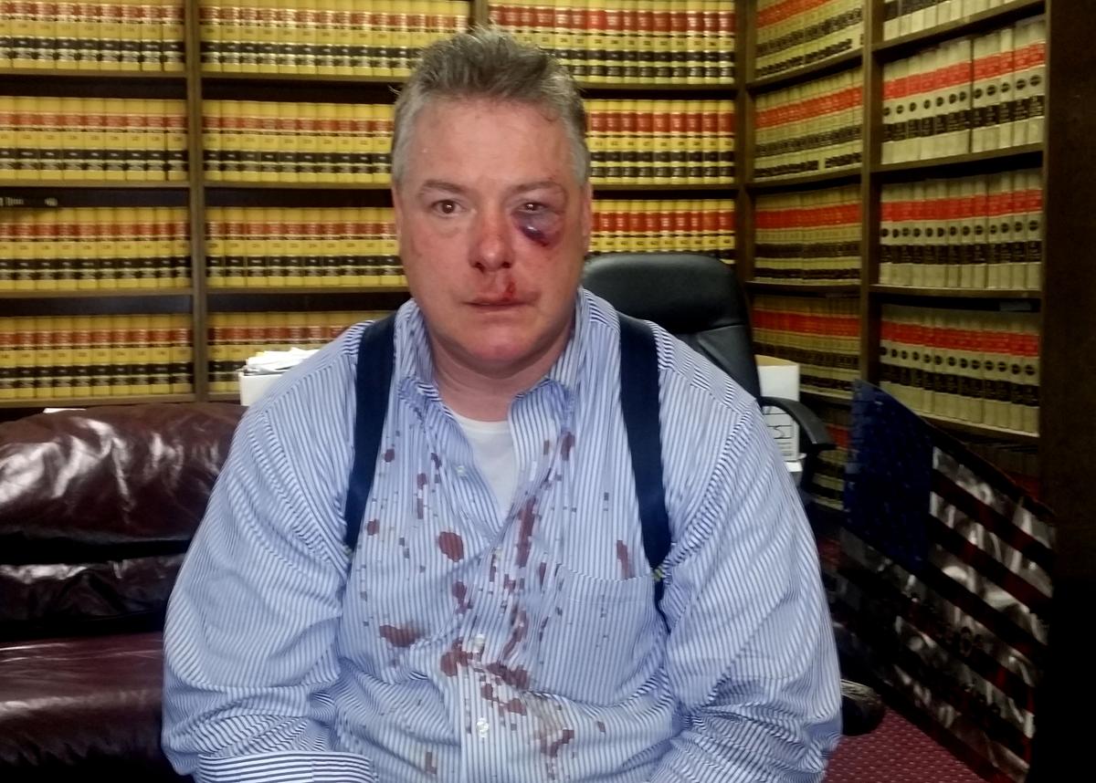 Defense Lawyer, Investigator Brawl in California Courthouse