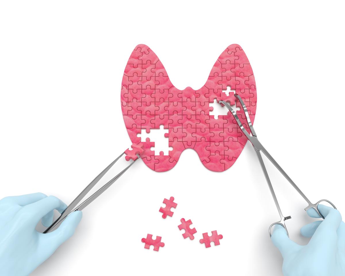Hypothyroidism - How to Heal the Thyroid