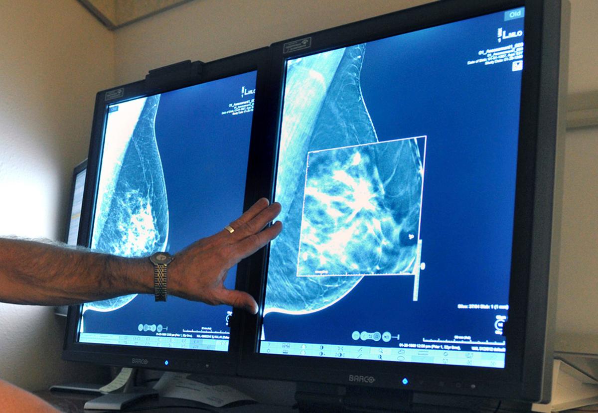 Experts Do Not Advise Routine Breast Cancer Screenings for Women Under 50