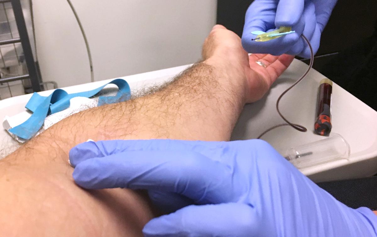 New York College Mumps Outbreak Prompts Vaccination Clinic