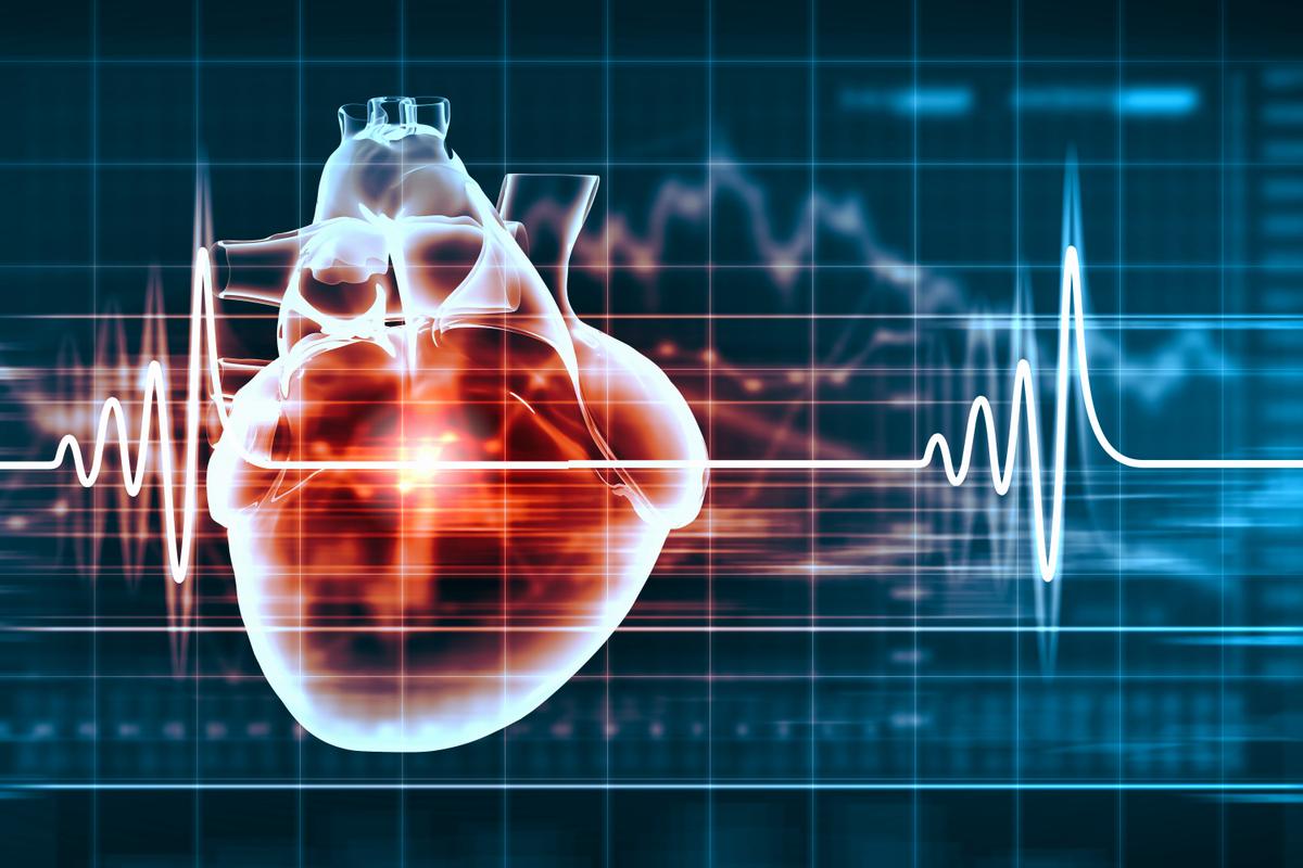Staying Cool Helps Brains After Cardiac Arrest