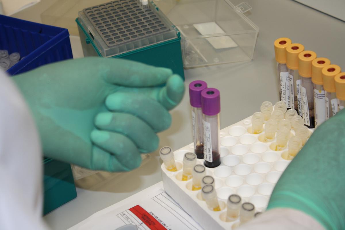 Tennessee to Begin Rejecting Most Federal Funding for HIV Programs