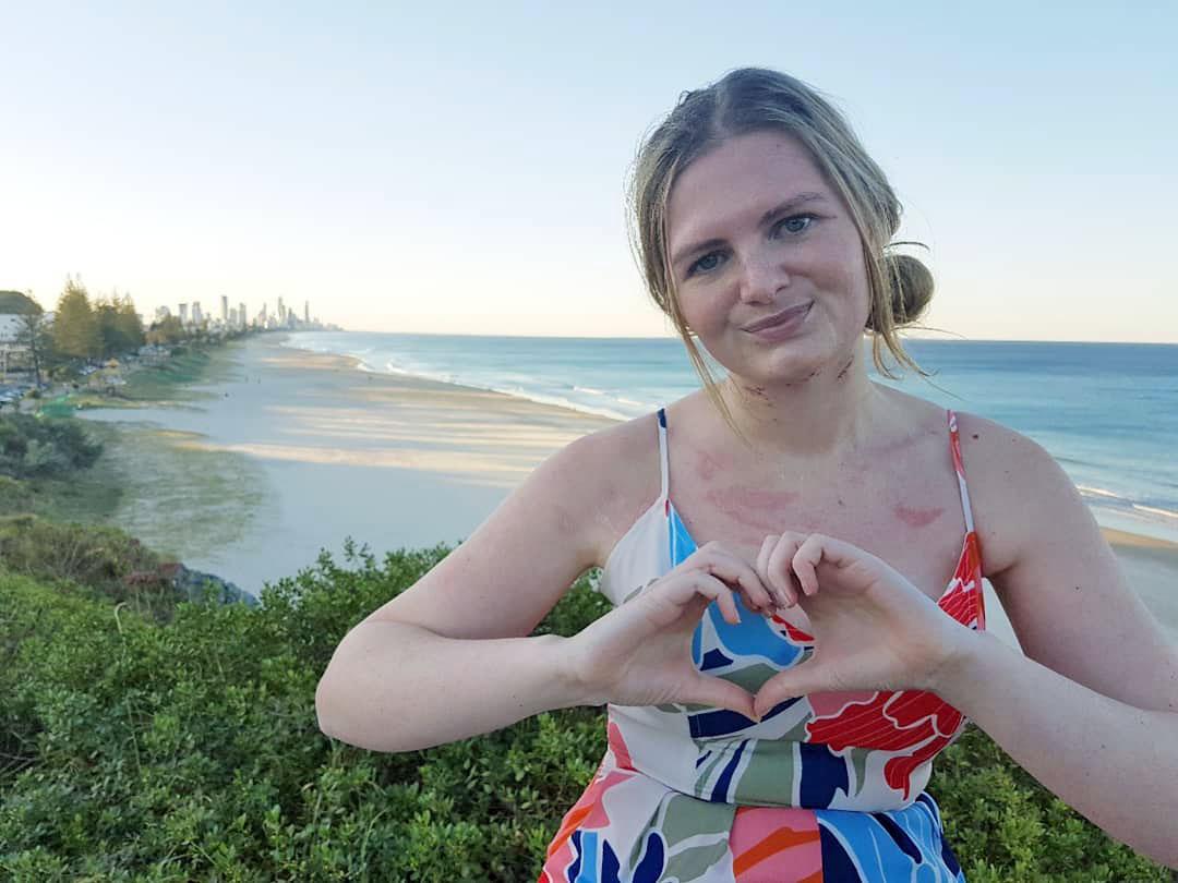 Woman Almost Loses Her Tongue From Severe Tooth Infection