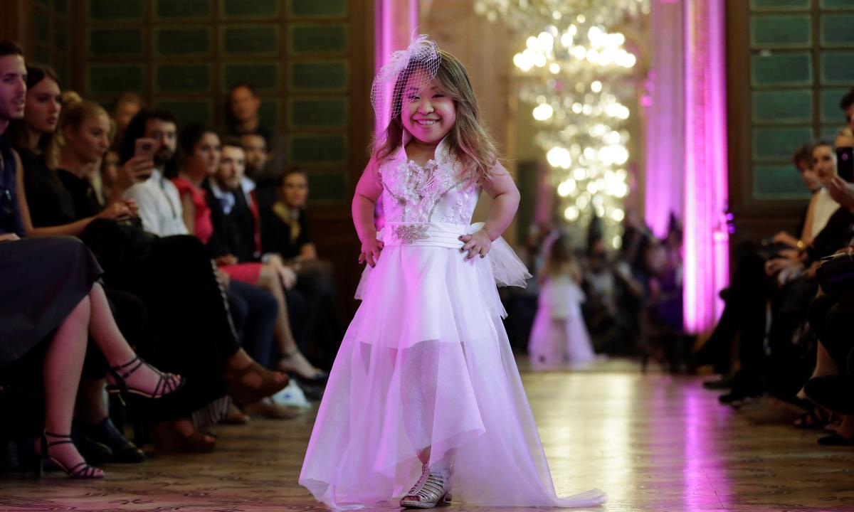 Couple Finds Love Through Limitations: ‘He’s My Long Legs,’ ‘She’s My Little Hands’