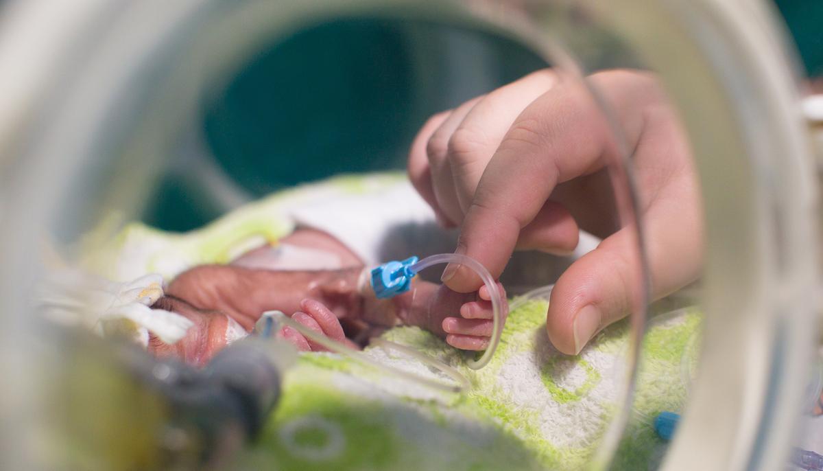 The Smallest Premie Baby Ever ‘Looked Like a Fetus,’ See How She’s Doing 3 Years Later