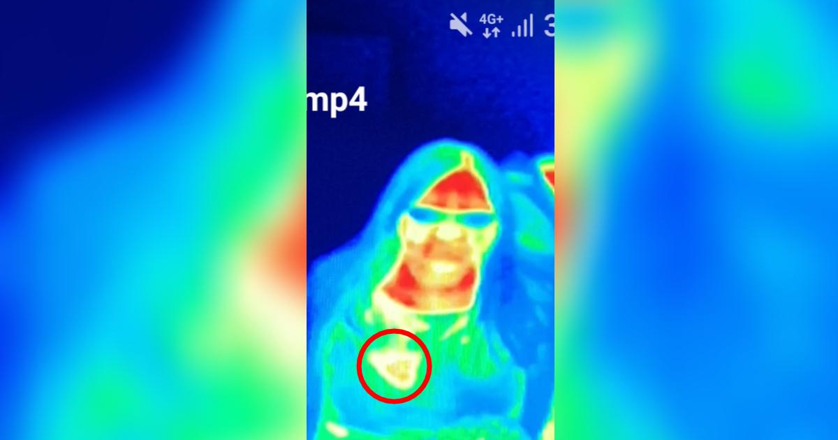 Woman Makes Life-Changing Breast Cancer Discovery After Visiting Thermal Camera Museum
