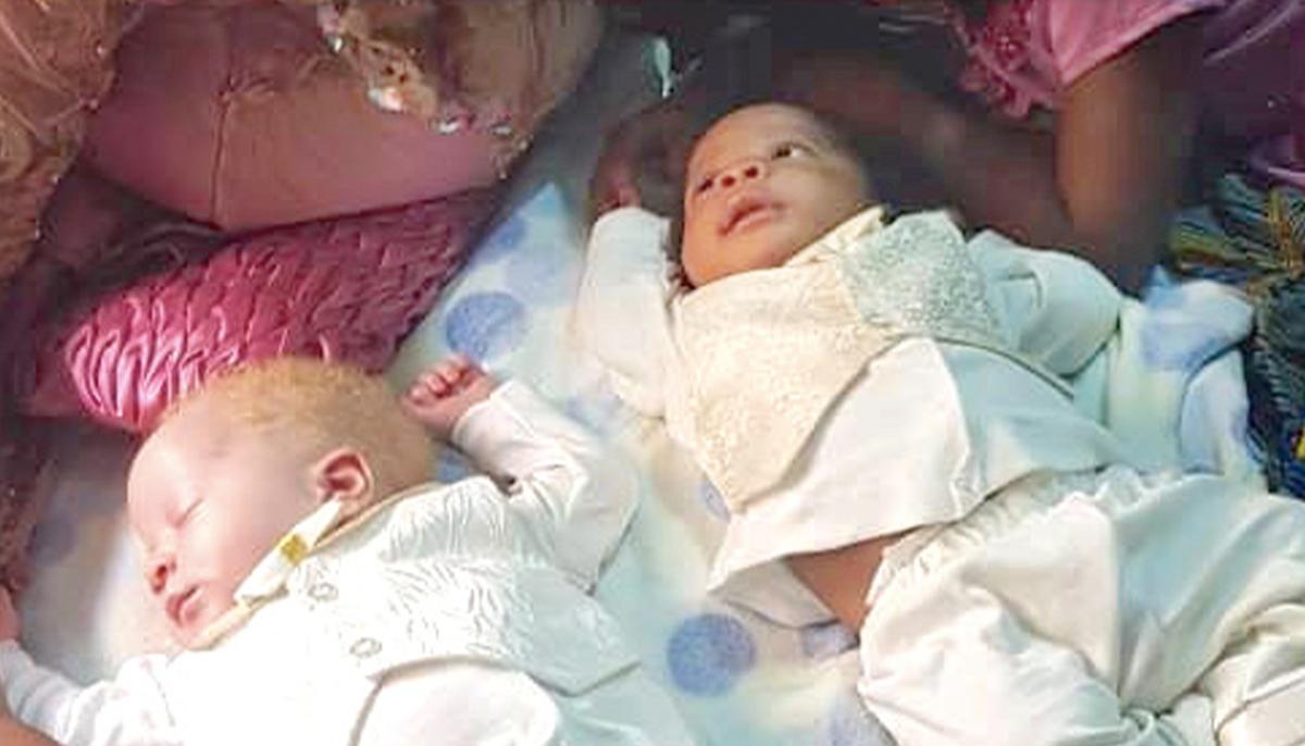 Mom Gives Birth to Rare Twins With Different Skin Colors, One Black and One White