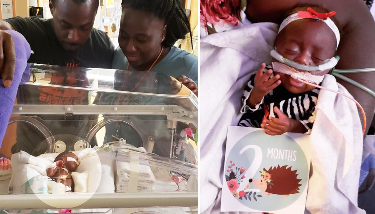 Mom’s Ultrasound Scare Leads to Baby Born 15 Weeks Premature Weighing Under 1 Pound