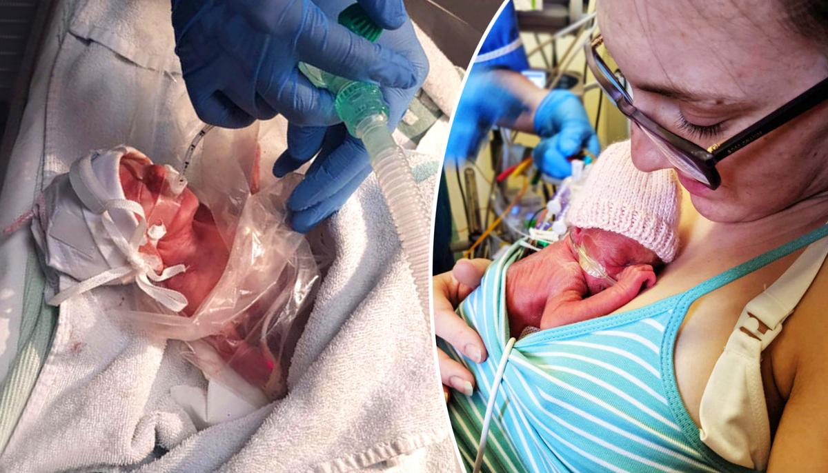 Preemie Born 4 Months Early Survives All Odds Despite Being Given 48 Hours to Live
