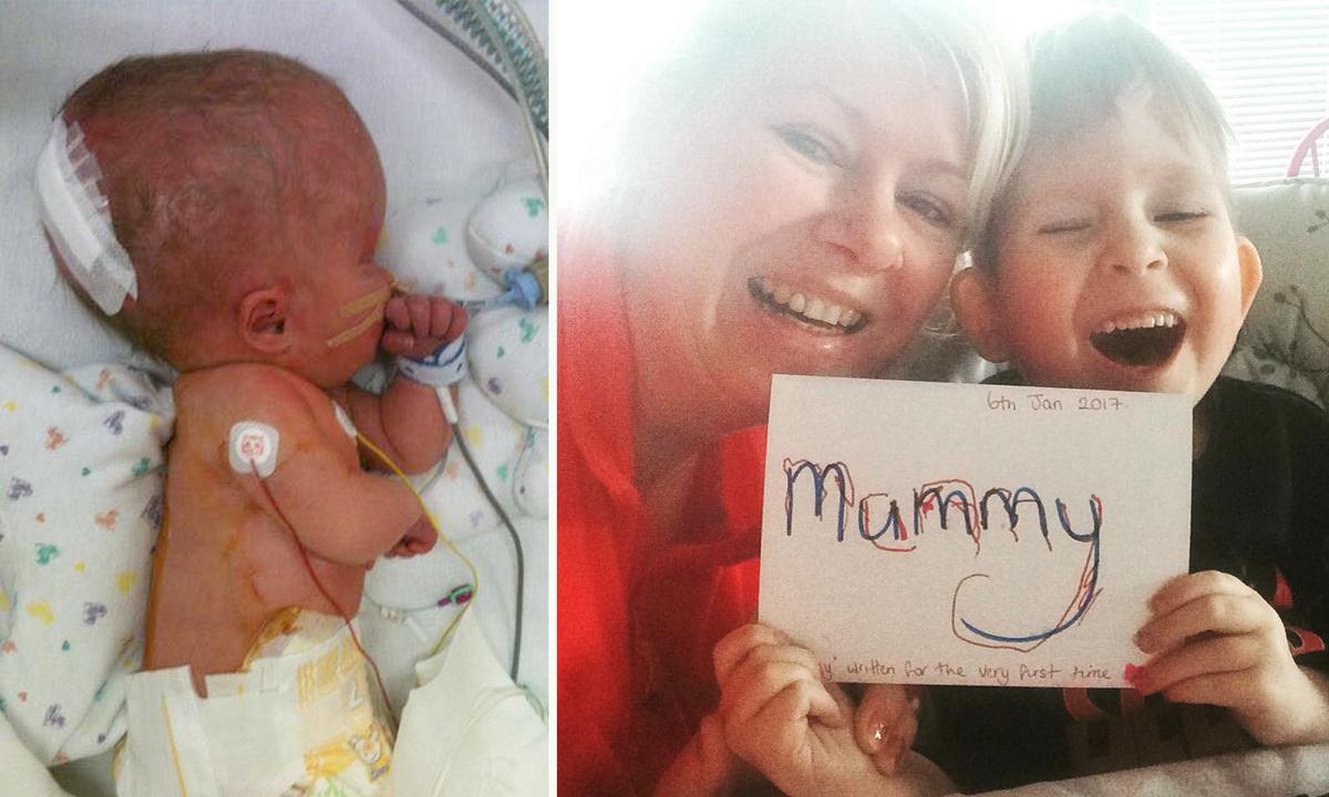 Mom Refused to Abort Boy Born With Only 2 Percent of His Brain–Now He Can Play Music