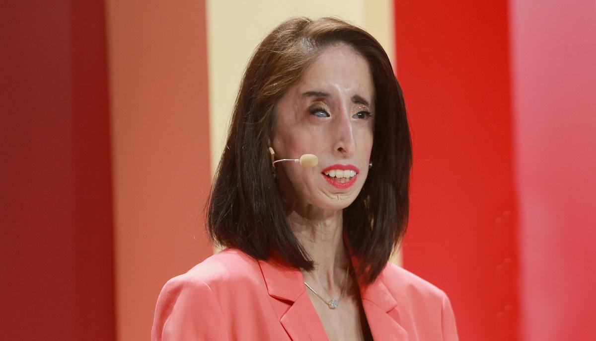 Woman Slams Parents for Using Photos of People With Disabilities to Mock Them in TikTok Trend