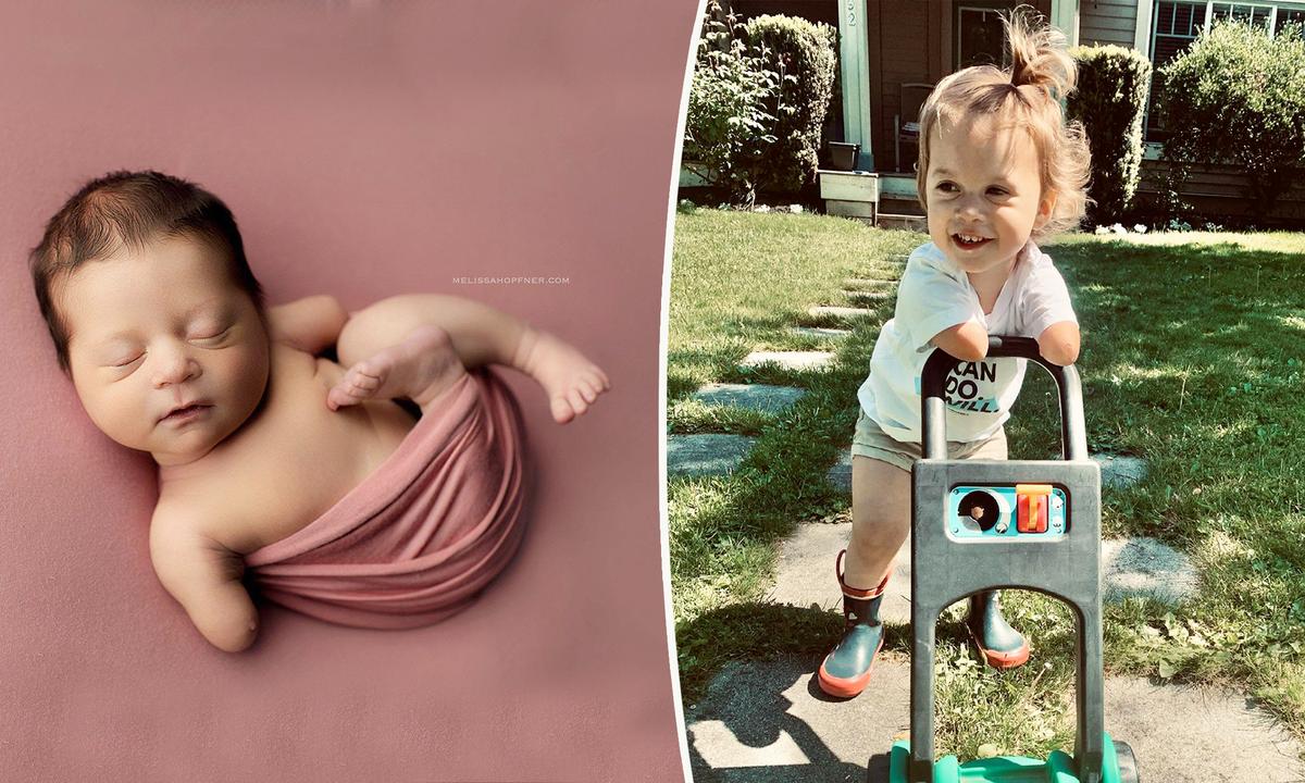 Mom of Baby Without Forearms Pens Letter to Doctor Who Advised Abortion: ‘I Remember You’