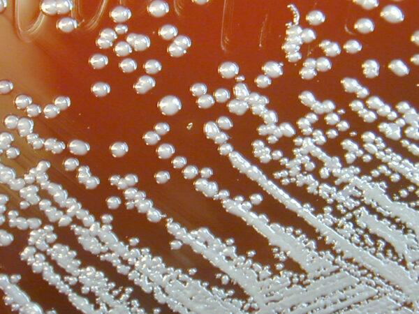 This image depicts a close view of Burkholderia pseudomallei bacteria that had then been incubated for a 48-hour time period, producing the colonial growth you see here. B. pseudomallei is the causative agent of the disease known as melioidosis.<br/>(Courtesy of Larry Stauffer/Oregon State Public Health Laboratory via CDC)