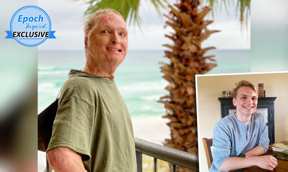 Student Who Was Pronounced Dead After College Fire Reclaims Life, Starts Fire Safety Nonprofit