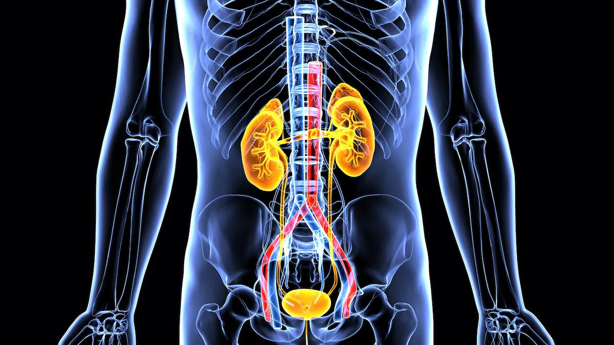 The Excruciating Pain of Kidney Stones: 2 Most Common Types and How to Prevent Them