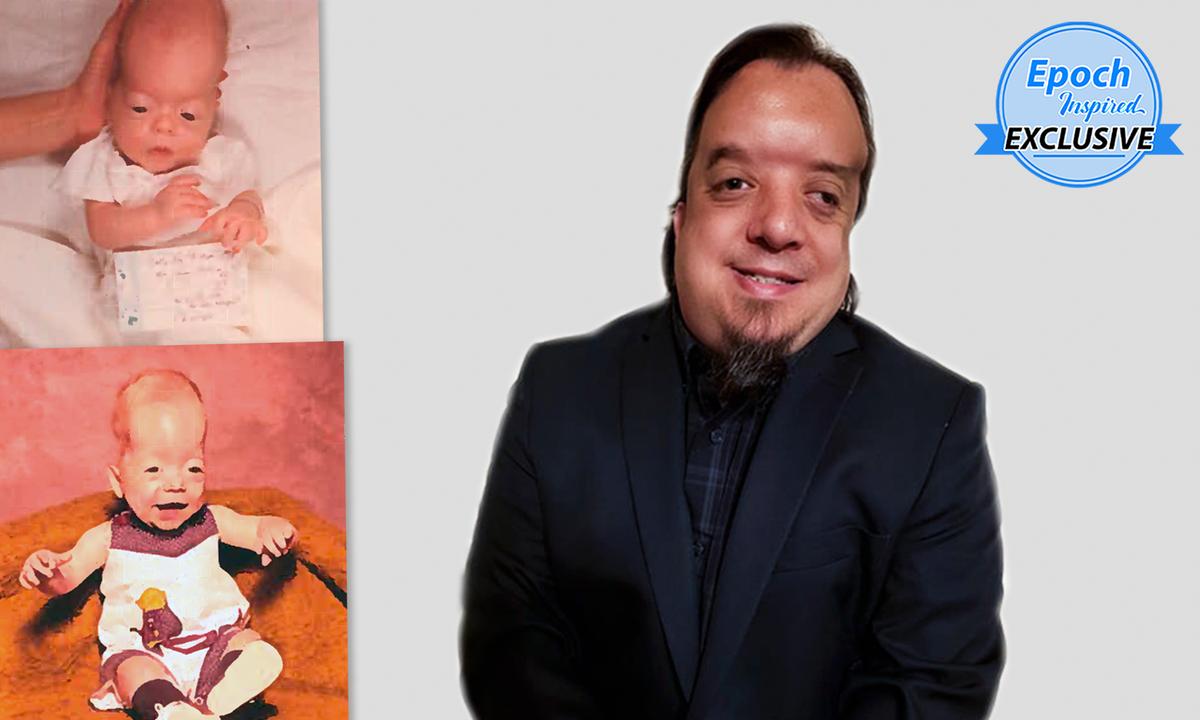 ‘God Created a Brain in My Head’: Boy Born Without a Brain Gets Healed, Inspires Others Toward Faith