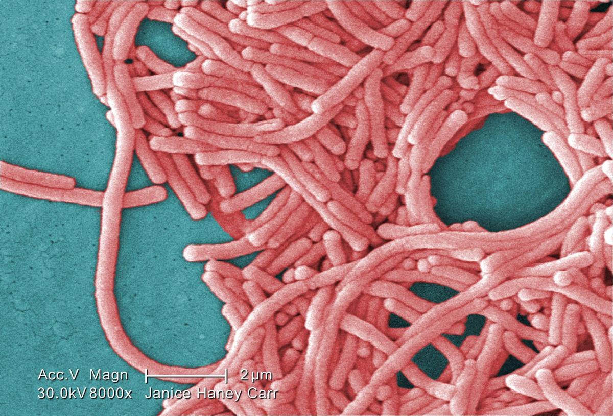 Montreal Public Health Investigating After Man Dies From Legionnaires’ Disease