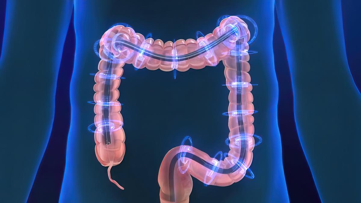 When Are You Too Old to Get a Colonoscopy?