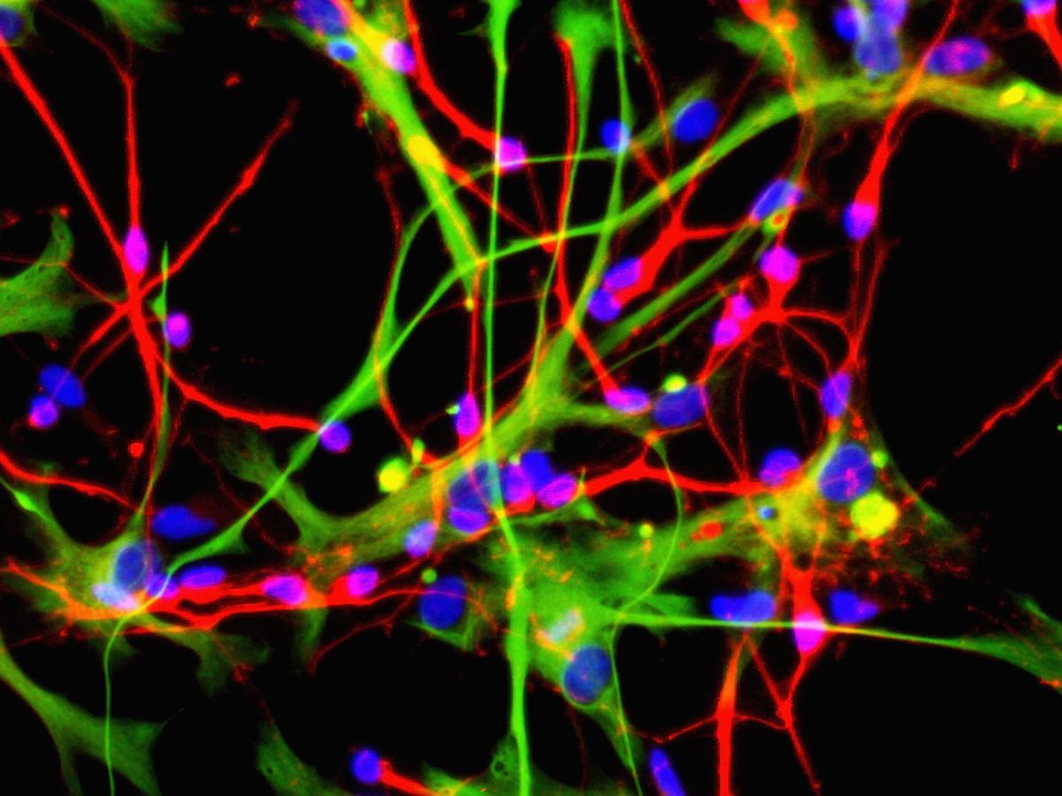 Researchers Develop Nanotechnology Technique to Restore Damaged Nerve Cells
