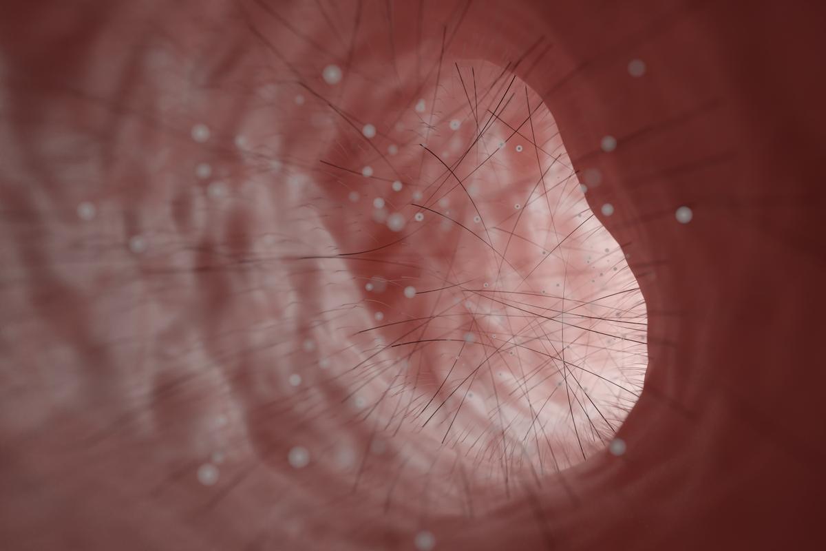 Nose Picking May Increase Risk of Dementia