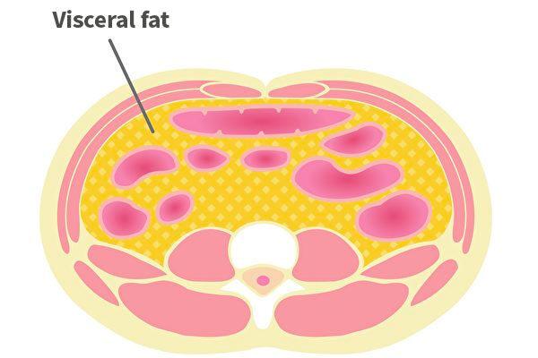 Visceral fat includes fatty tissue that surrounds the liver and digestive organs and tends to accumulate in the abdomen after middle age. (Barks/Shutterstock)