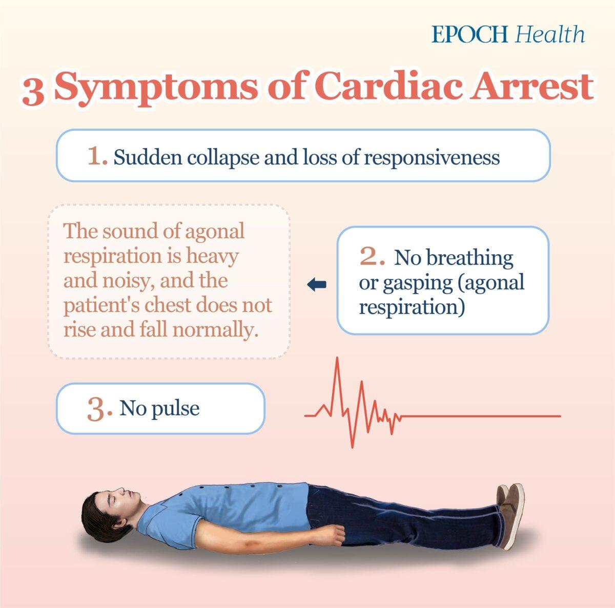 Cardiac arrest symptoms include sudden collapse, no breathing, and no pulse. (The Epoch Times)