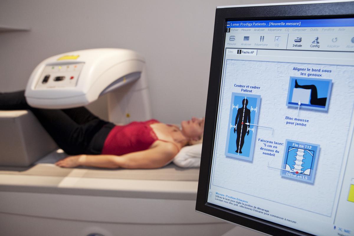 The Manufacturing of Bone Diseases: The Story of Osteoporosis and Osteopenia