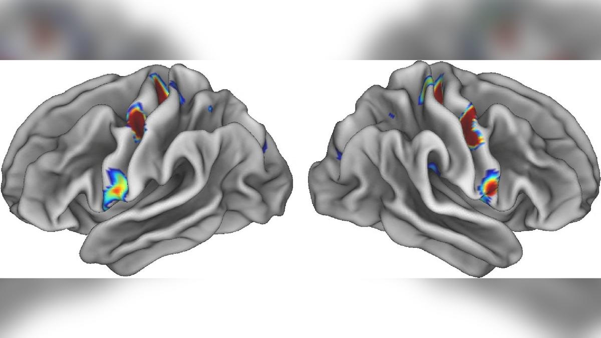 Scientists Identify Mind-Body Nexus in Human Brain