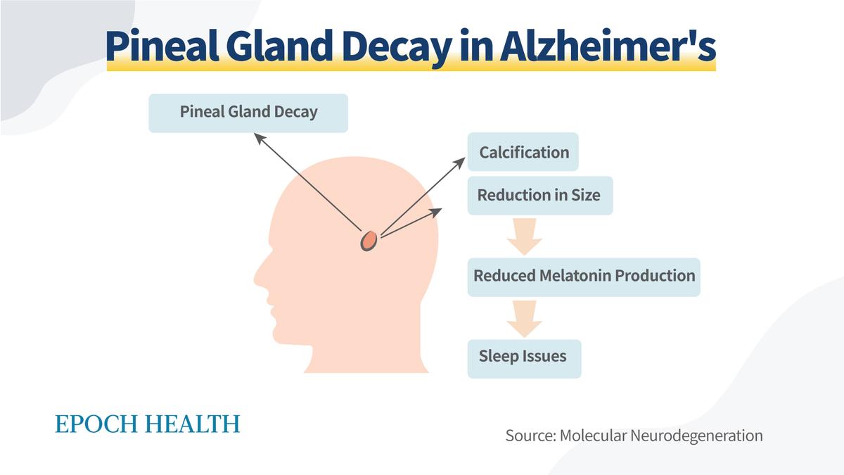 In Alzheimer's disease, the pineal gland accumulates large amounts of calcium, reducing melatonin production. (The Epoch Times)