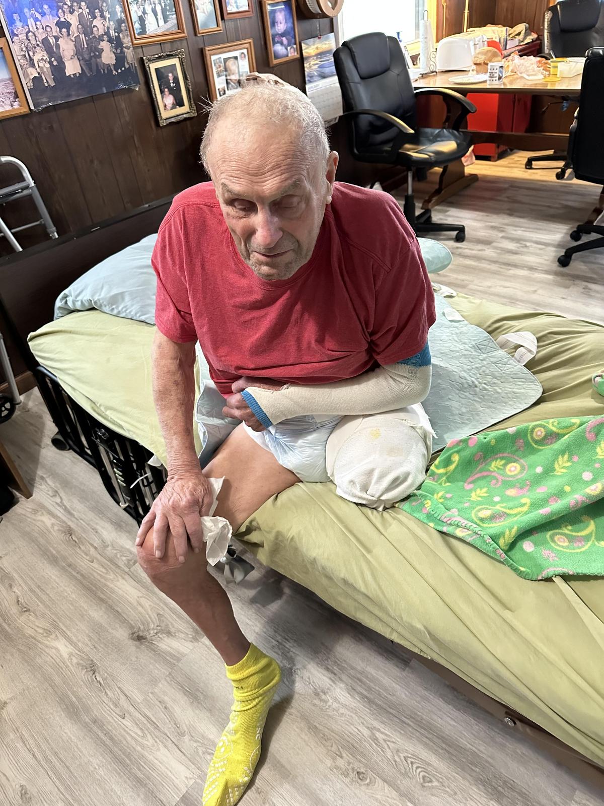 Mr. Dan Nowacki after experiencing two strokes and a leg amputation from doses of Remdesivir contaminated with glass particles, on Jan. 13, 2023. (Photo via Ven Johnson Law)