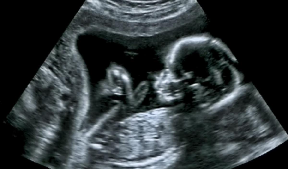 Pfizer Drip Feeds Data From Its Pregnancy Trial