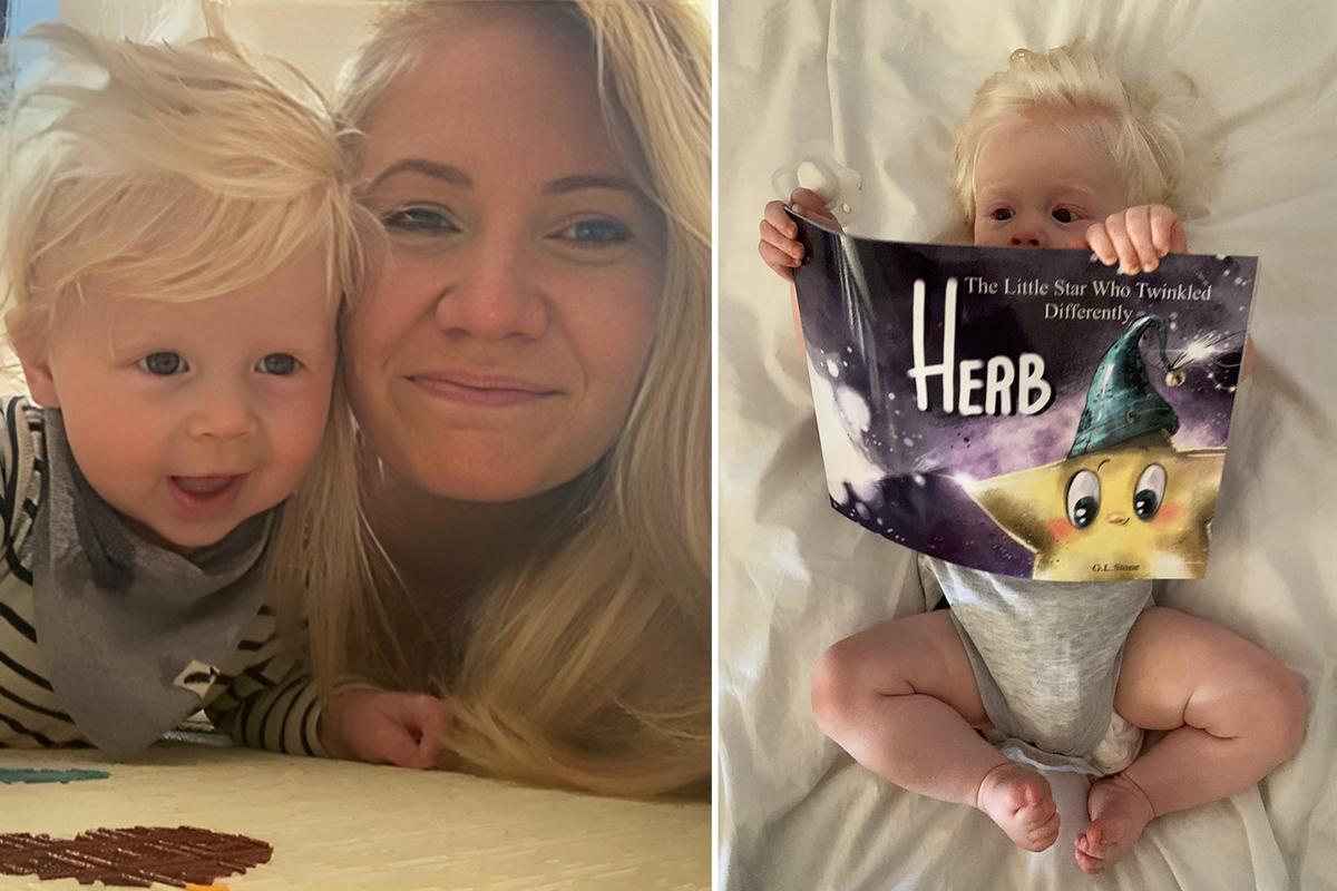 Mom of Boy Born With Snow White Hair and Visual Disability Becomes Children’s Author to Share Her Son’s Story