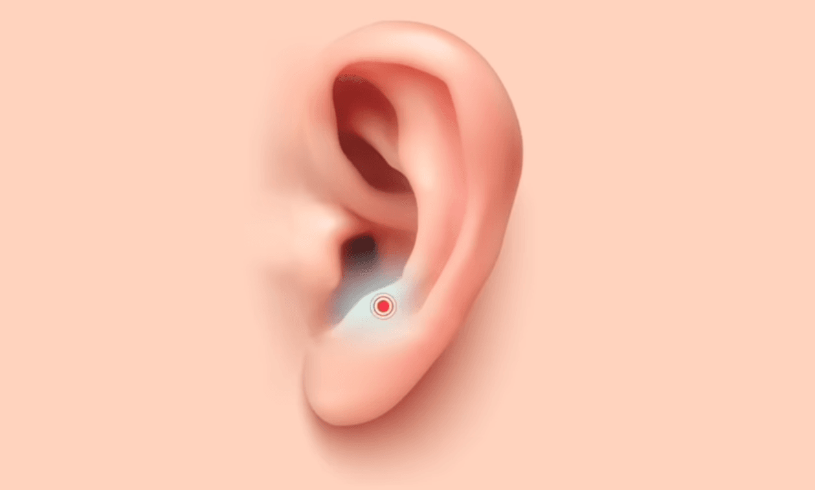 Parathyroid acupoint. (The Epoch Times)