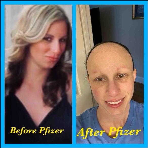 Before and after photos of Lyndsey House, healthcare worker who was injured by the Pfizer COVID-19 vaccine. (Courtesy of Lyndsey House)