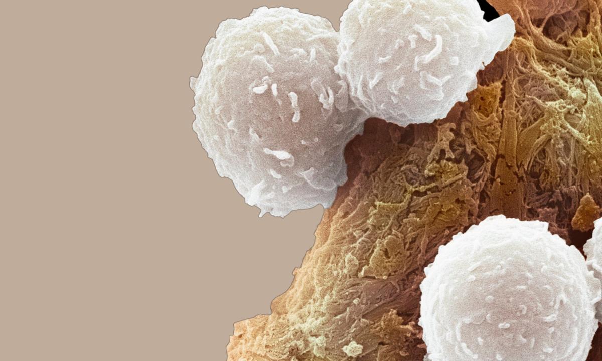 Cancer Cells ‘Cooperate’ to Survive, Study Finds