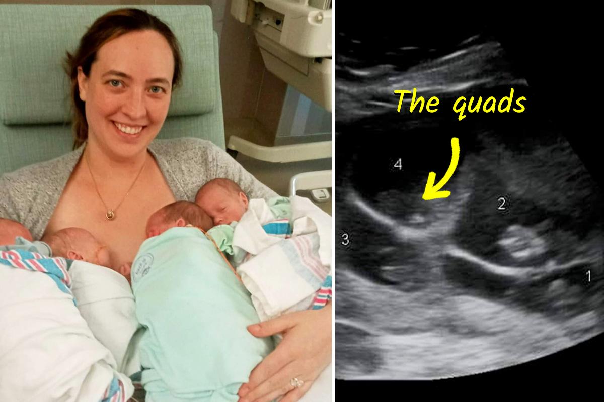 Mom Who Lost 4 Children Gives Birth to Rare Identical Quadruplets: ‘It Almost Felt Like Fate’